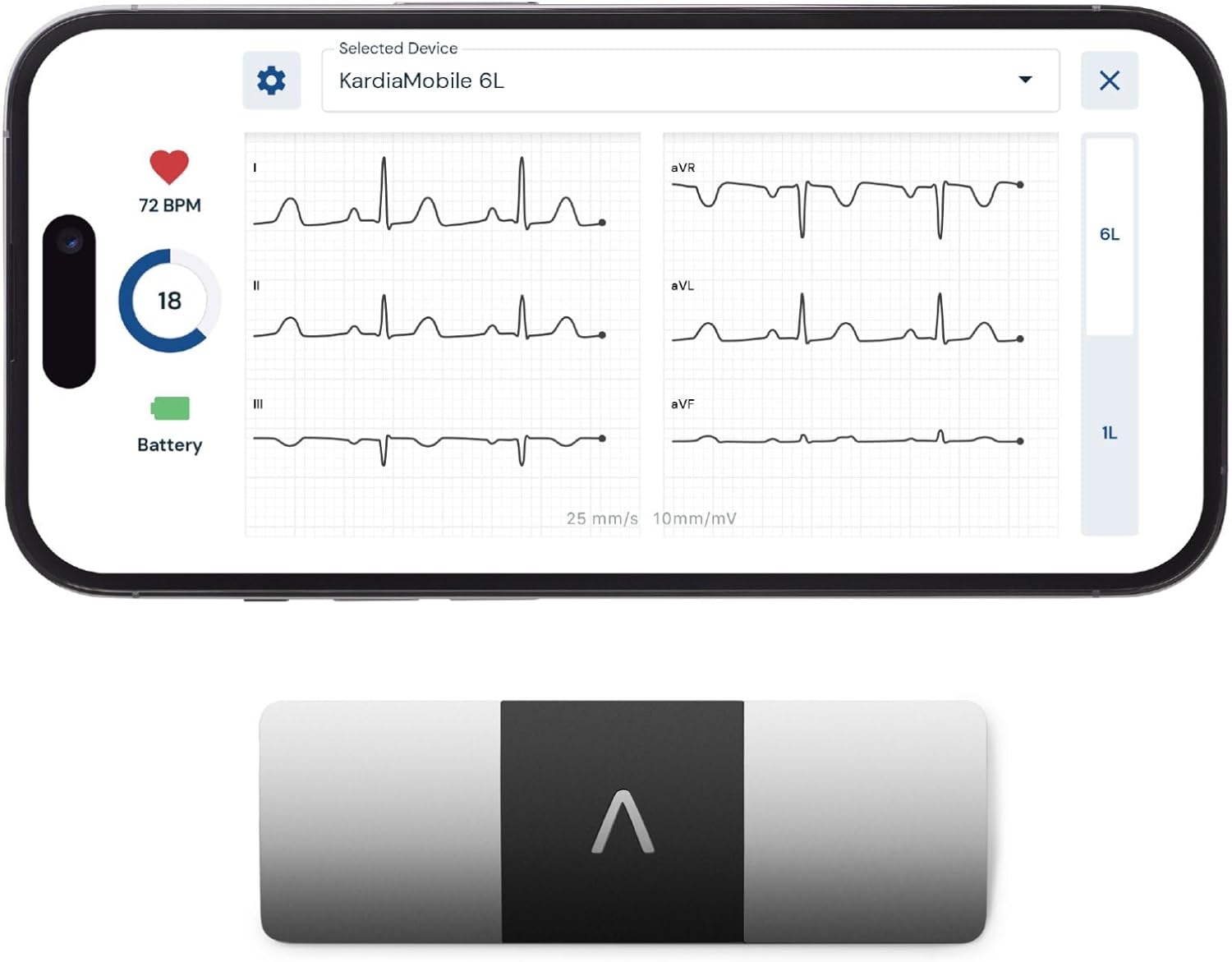 KardiaMobile 6-Lead ECG Monitor